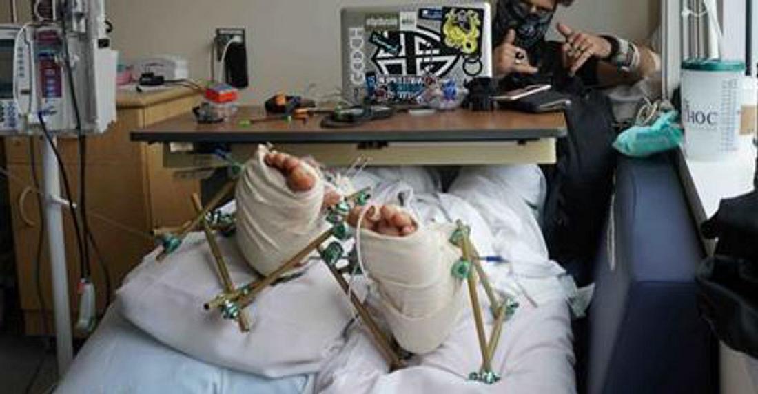 YouTuber 8Booth mit zwei gebrochenen Füßen im Krankenhaus