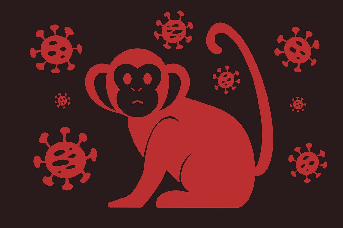 Grafik mit Affen und Affenpocken