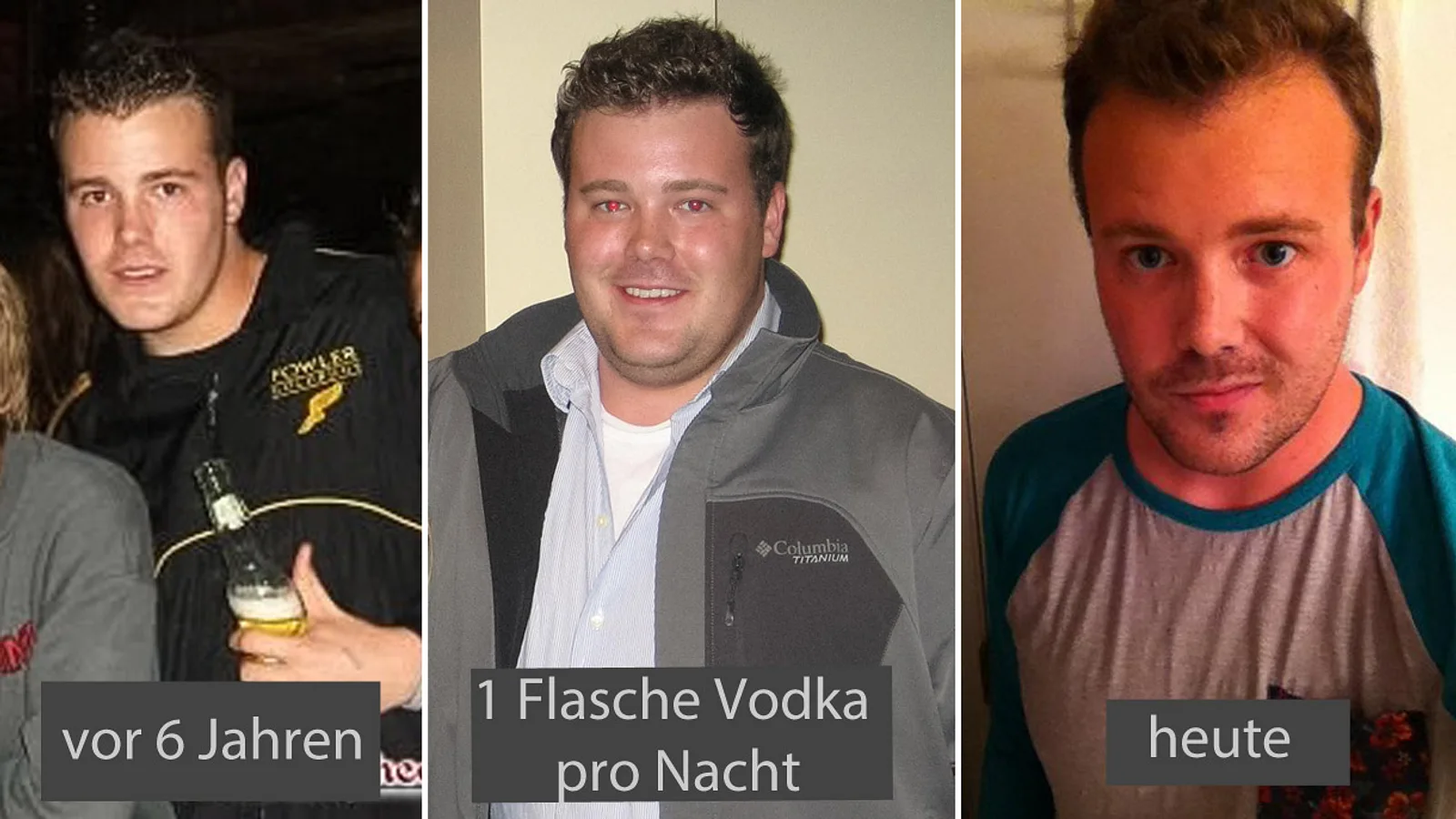 Spannende Bei Welcher Krankheit Riecht Man Nach Alkohol Fotos