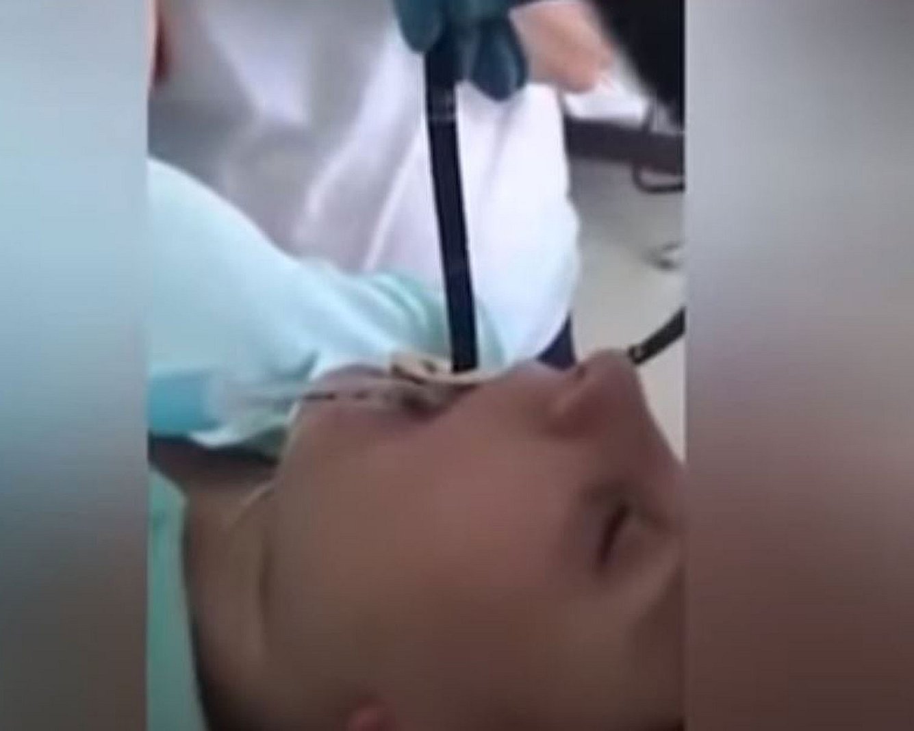 Horror-Clip: Ärzte holen meterlange Schlange aus Rachen einer Frau Frau mit Schlauch im Mund im Krankenhaus
