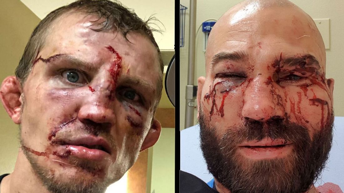 Bare Knuckle FC: Artem Lobov und Jason Knight nach dem Kampf