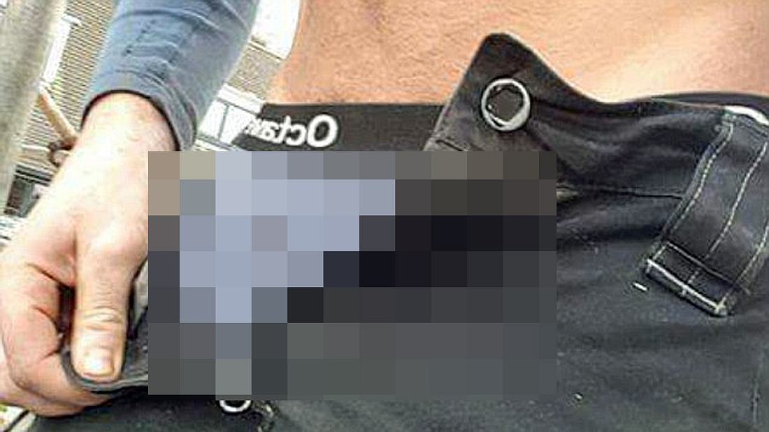 Unfall: Sam Rees hat sich versehentlich einen Nagel in seinen Penis geschossen Der britische Bauarbeiter Sam Rees hat sich einen Nagel in seinen Penis geschossen