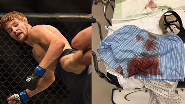 Bryce Mitchell und seine blutigen Boxer - Foto: Twitter / Bryce Mitchell