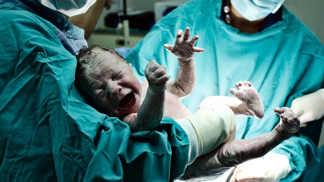 Neugeborenes direkt nach der Geburt in den Händen von Ärzten - Foto: iStock / Reynardt