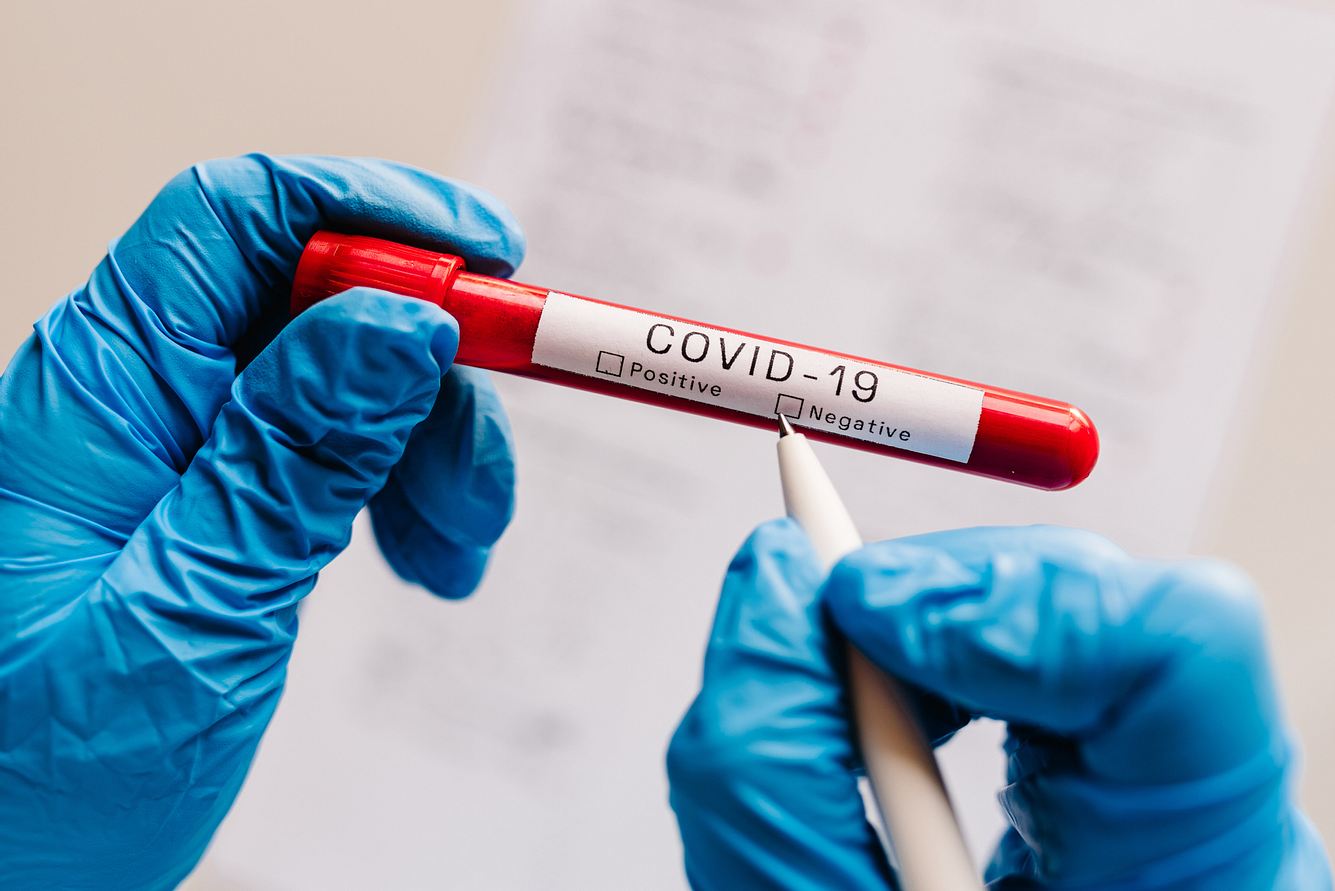 Corona-Lockdown: Bayerisches Labor liefert reihenweise Falschergebnisse Markierung eines Corona-Tests als negativ