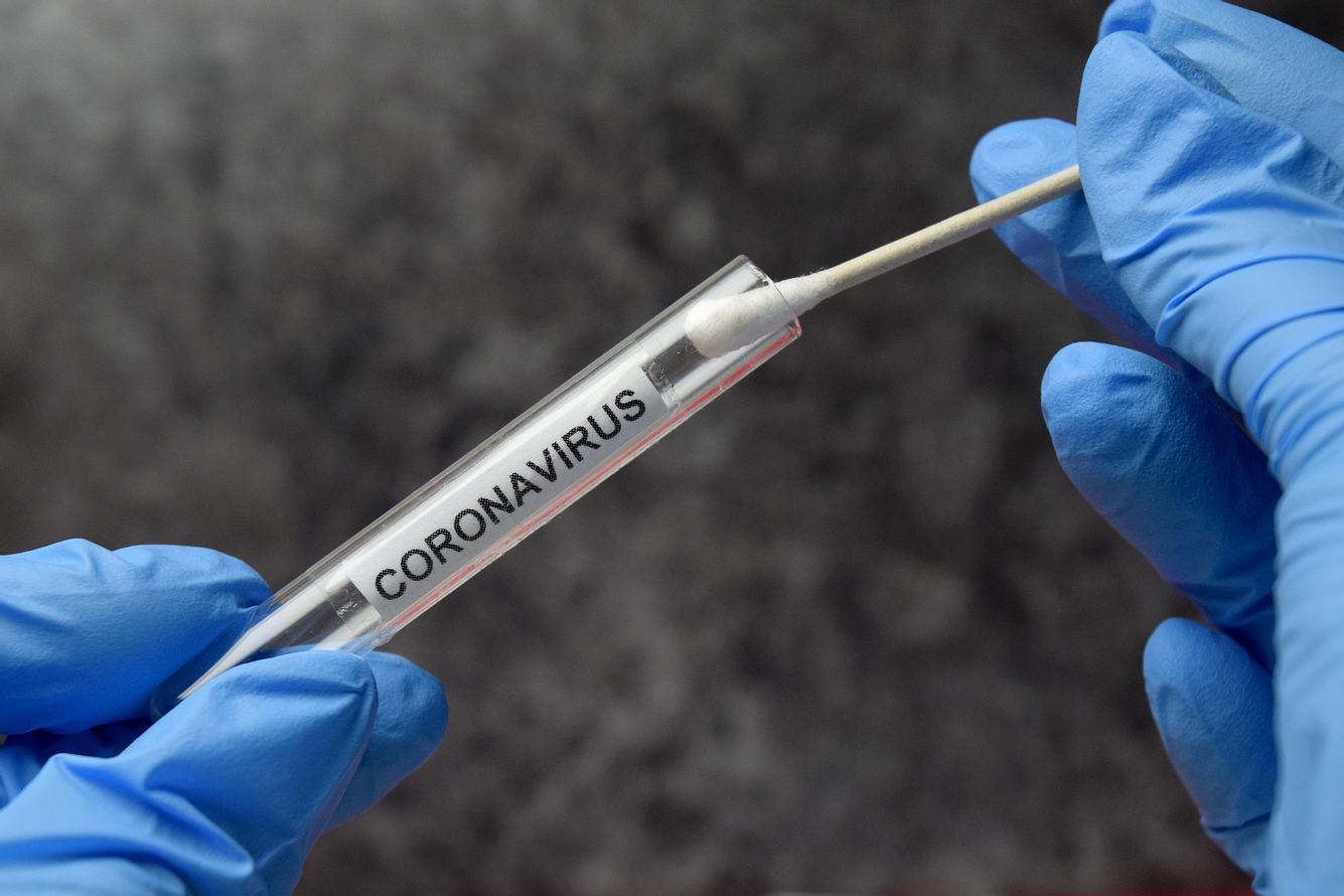 Neue Methode: Corona-Test jetzt auch per Anal-Abstrich Corona-Test