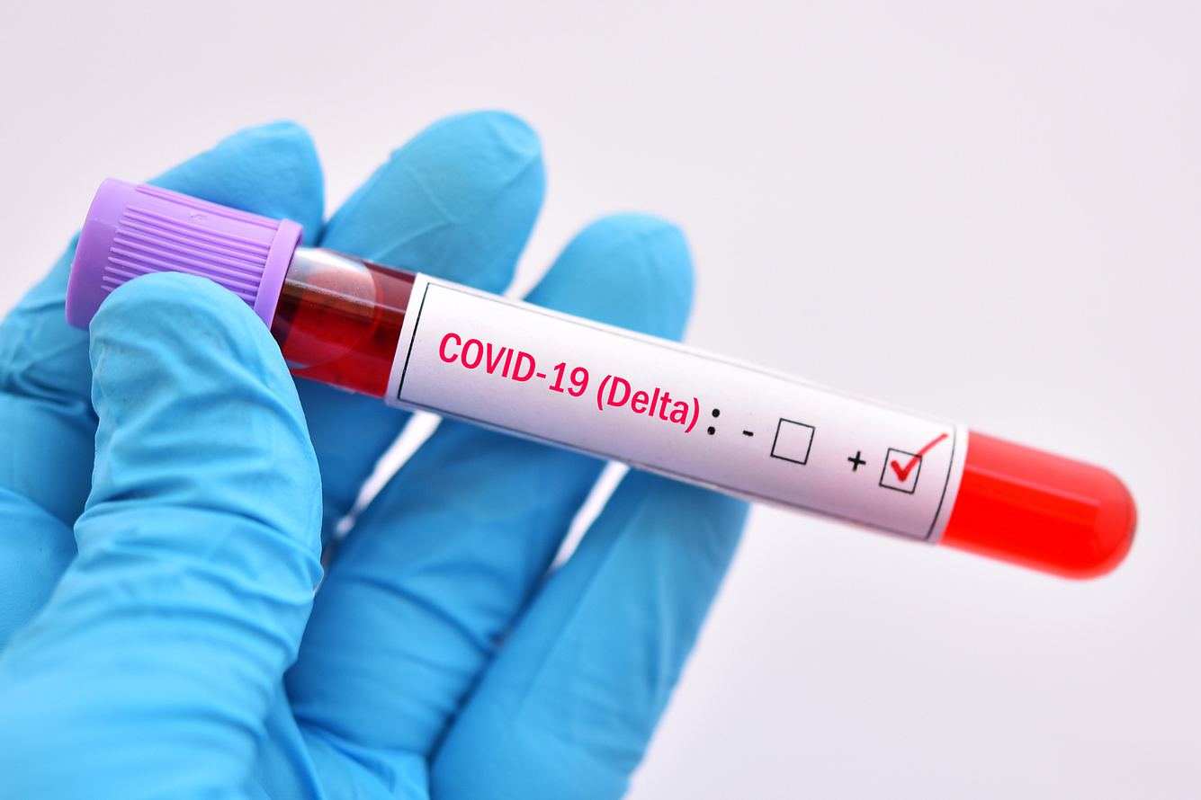 Blutprobe mit Delta-Variante des Coronavirus