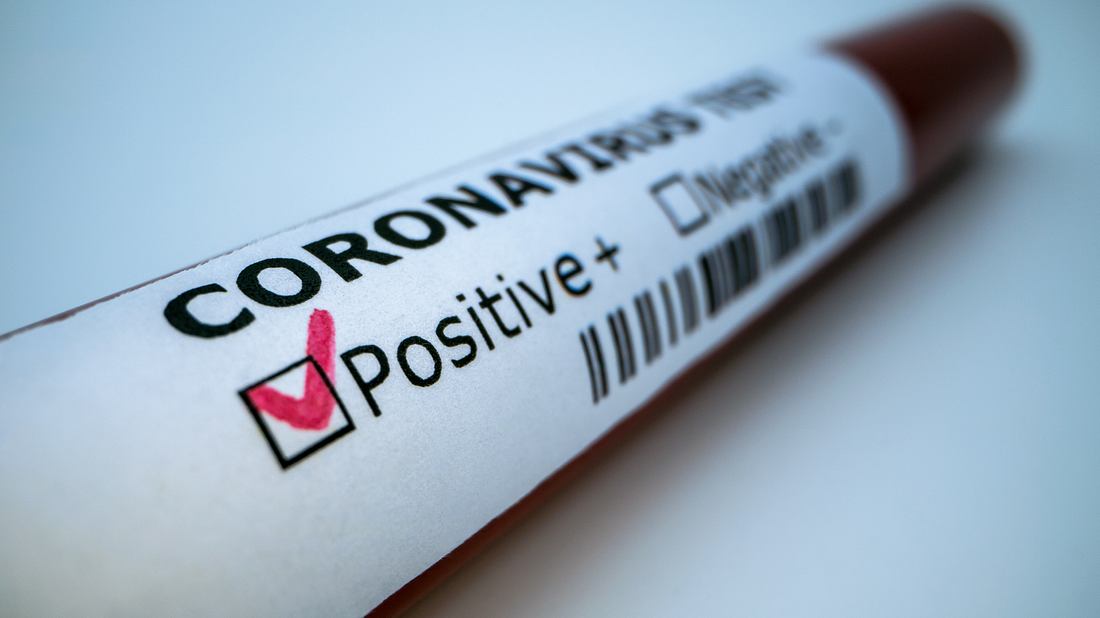 Coronavirus-Test Coronavirus-Test