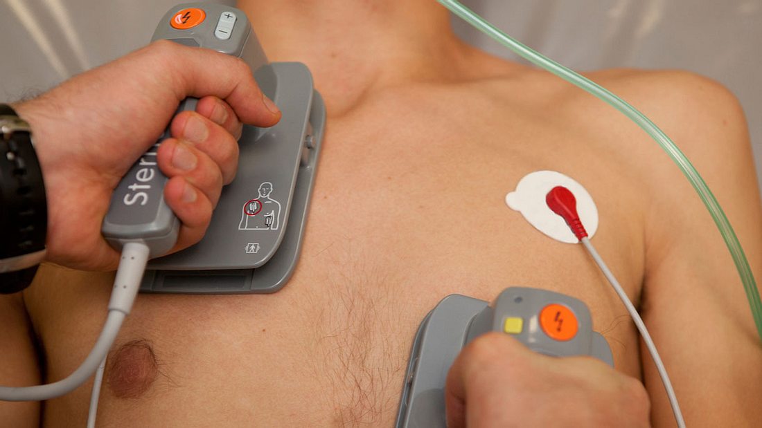 So wird ein Defibrillator richtig benutzt. Defibrillator