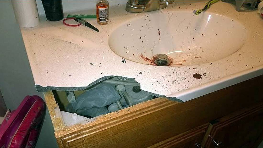 Andrew Hall verlor bei der Explosion seiner E-Zigarette sieben Zähne