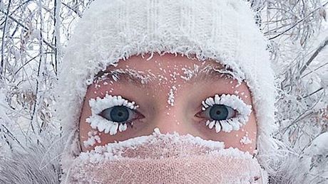 Die Folgen von minus 62 Grad Celsius - Foto: anastasiagav/Instagram