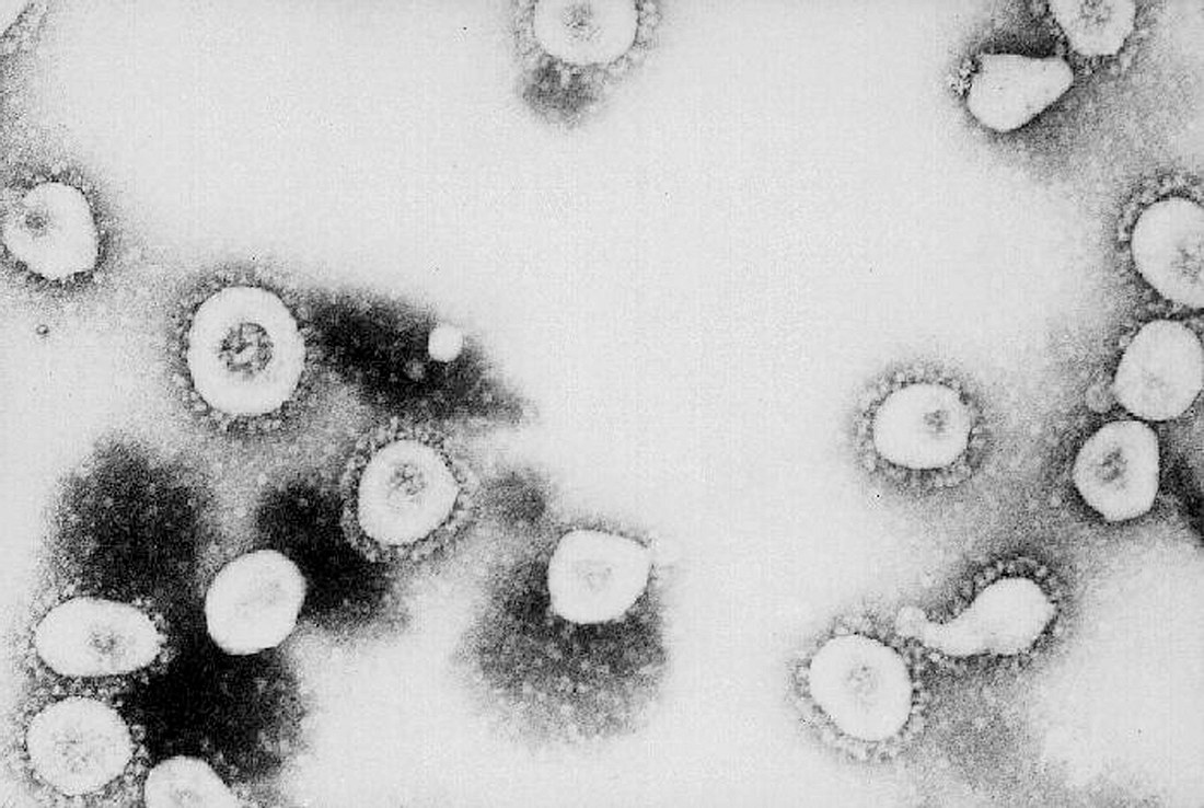Erschreckende Studie zeigt: Coronavirus überlebt 4 Stunden in der Luft Das Coronavirus