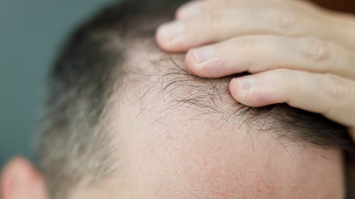 Mann streicht sich durchs Haar