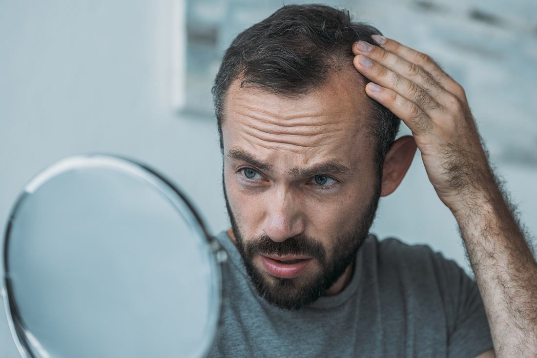 Haarausfall und seine mögliche Ursache Mann betrachtet sein Haar im Spiegel