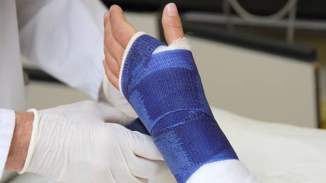 Hand mit Gips  - Foto: iStock / :jacus