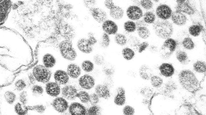 Historischer Fehler: Warum das Coronavirus zuerst übersehen wurde
