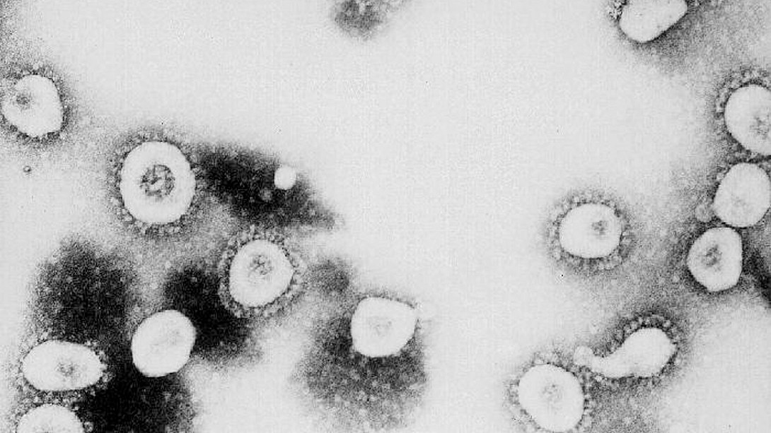 Forscher sicher: Coronavirus kann beim Atmen übertragen werden
