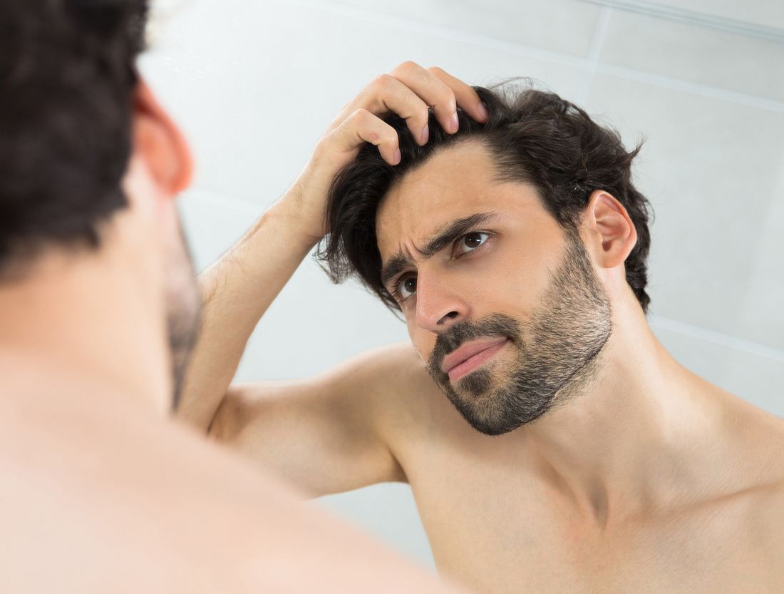 Männer und Haarausfall: Diese 7 Hausmittel beugen einer Glatze vor Männer und Haarausfall: Diese 7 Hausmittel beugen einer Glatze vor