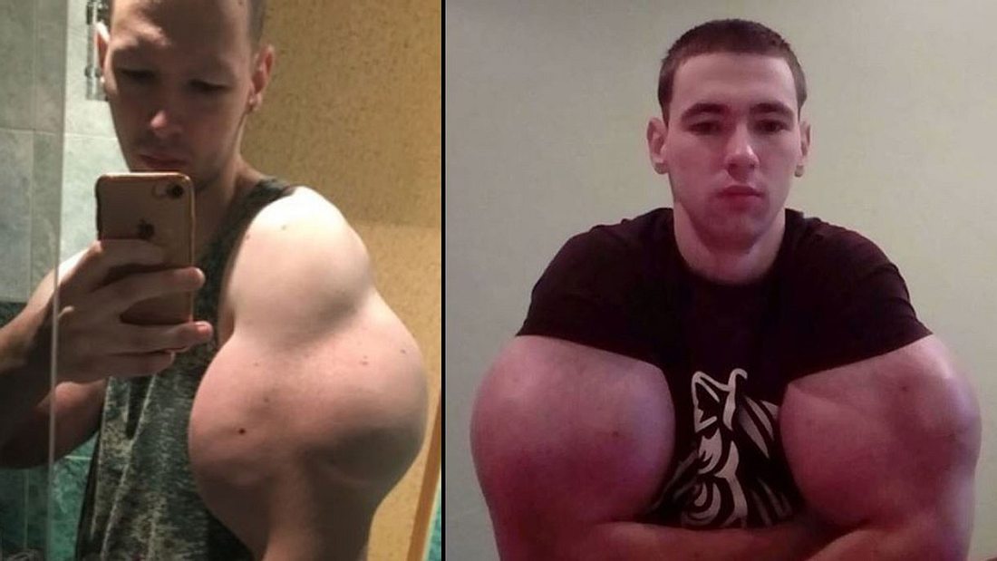 Kirill Tereshin und sein Bizeps Kirill Tereshin und sein Bizeps