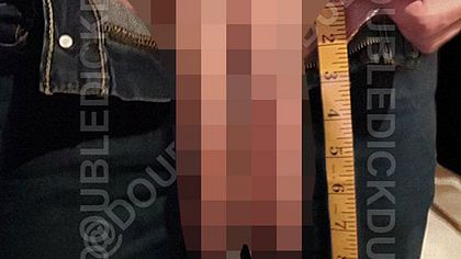 Mann Mit 2 Penisen Mann Mit 2 Penisen