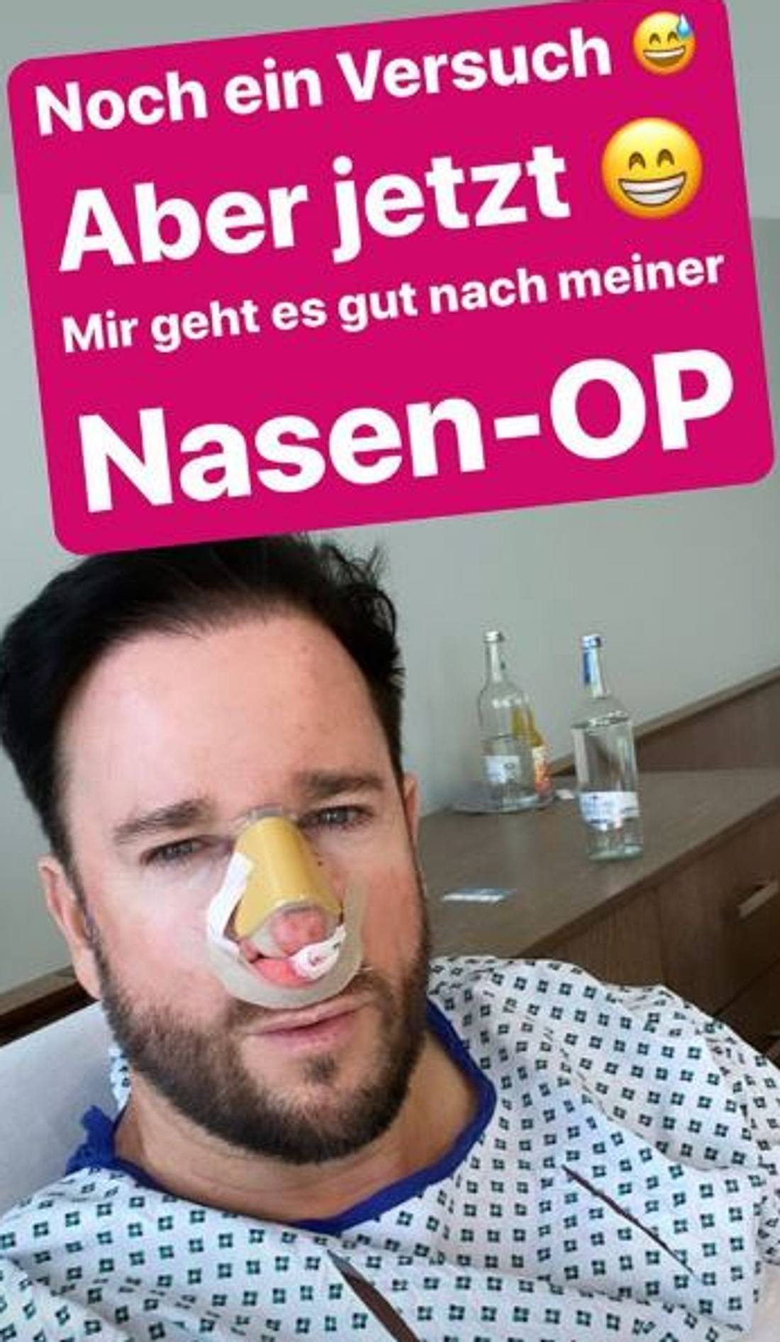 Michael Wendler nach seiner Nasen-OP Michael Wendler nach seiner Nasen-OP