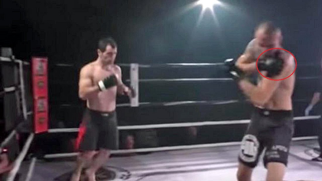 MMA-Fighter Paata Tschapelia kugelt die Schulter seines Gegners Arkadiusz Wroblewski wieder an
