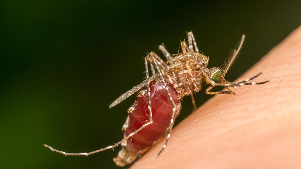 Nach Mückenstich: Einer Kölnerin müssen beide Beine und ein Arm amputiert werden