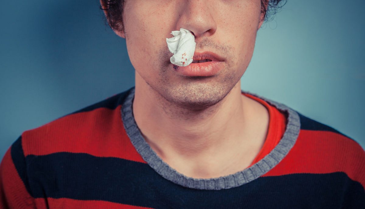 Nasenbluten: Ursachen & Was tun bei Nasenbluten?