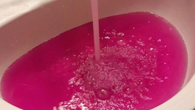 Im kanadischen Onoway lief pinkes Leitungswasser aus den Hähnen - Foto: twitter / ShallimaGlobal