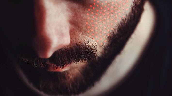 Männergesicht mit roten Punkten - Foto: iStock / Bojanikus, Collage / bearbeitet durch Männersache