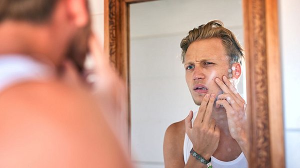 Hausmittel gegen Pickel: So kannst du Mitesser entfernen - Foto: iStock / PeopleImages