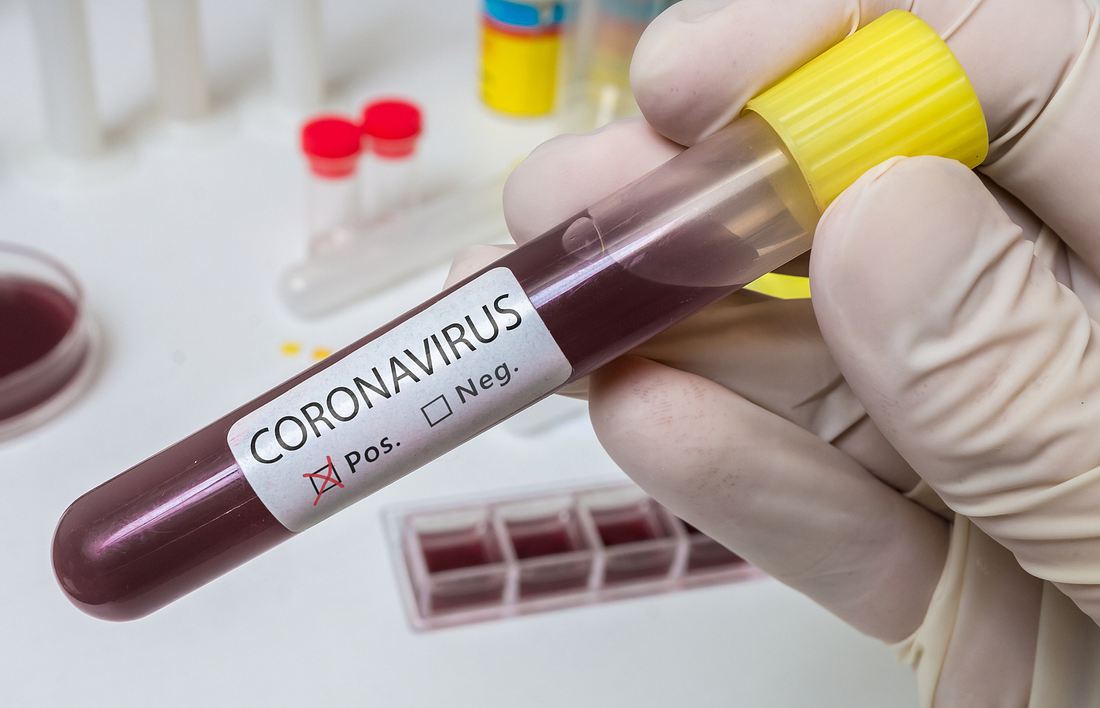 Positiver Coronatest Positiver Coronatest