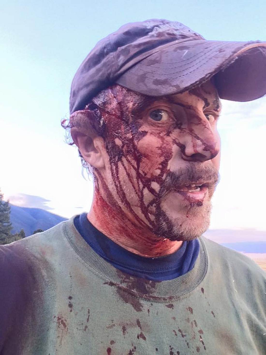 Überlebte die Attacke eines Grizzly-Bären: Todd Orr